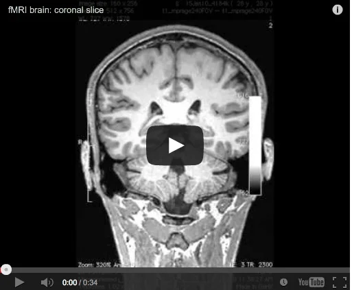 激レア！SMITH & MIGHTY / BRAIN SCAN Smith & Mighty – Brain Scan – Vinyl (7
